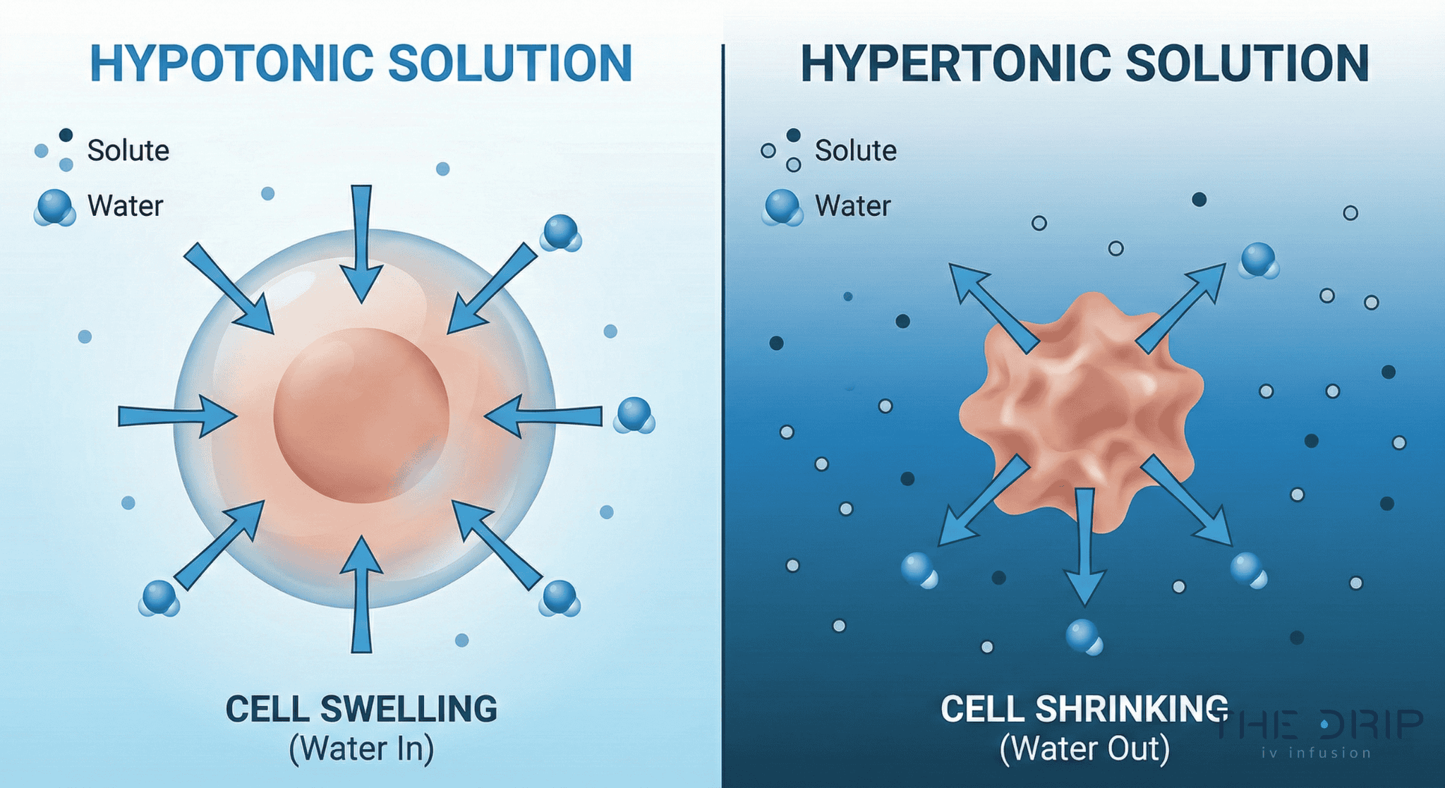 hypotonic-vs-hypertonic-fluid-movement Medical diagram showing water movement in and out of cells under hypotonic and hypertonic IV therapy.