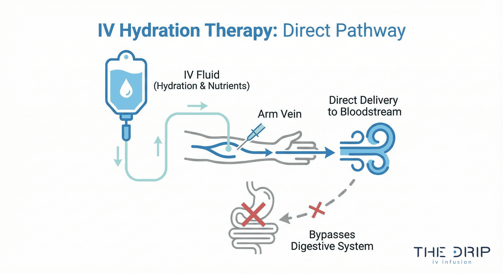 iv-fluid-absorption-process-diagram Diagram showing IV hydration bypassing digestive system and going directly into bloodstream.