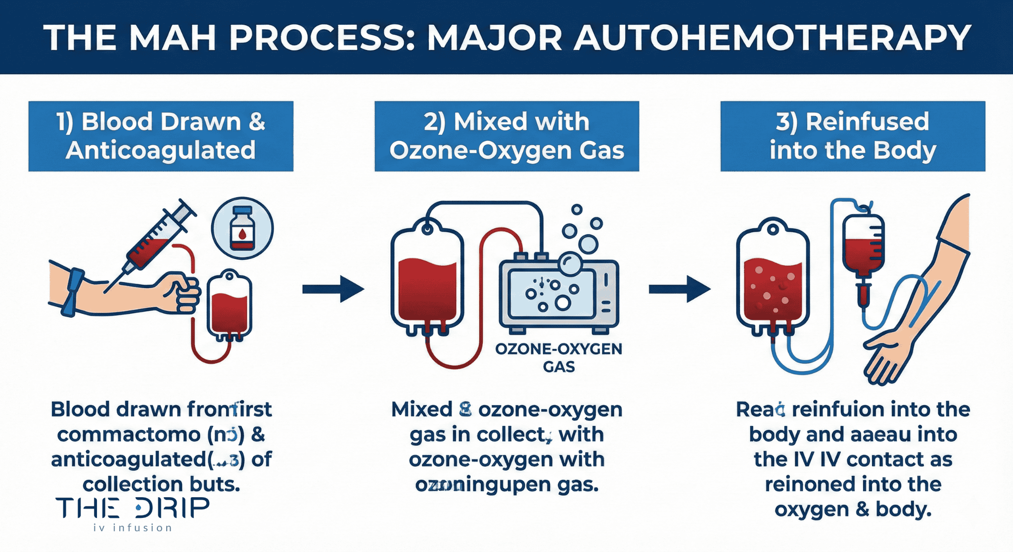 major-autohemotherapy-process-diagram Diagram showing how blood is treated with ozone and reinfused during MAH.