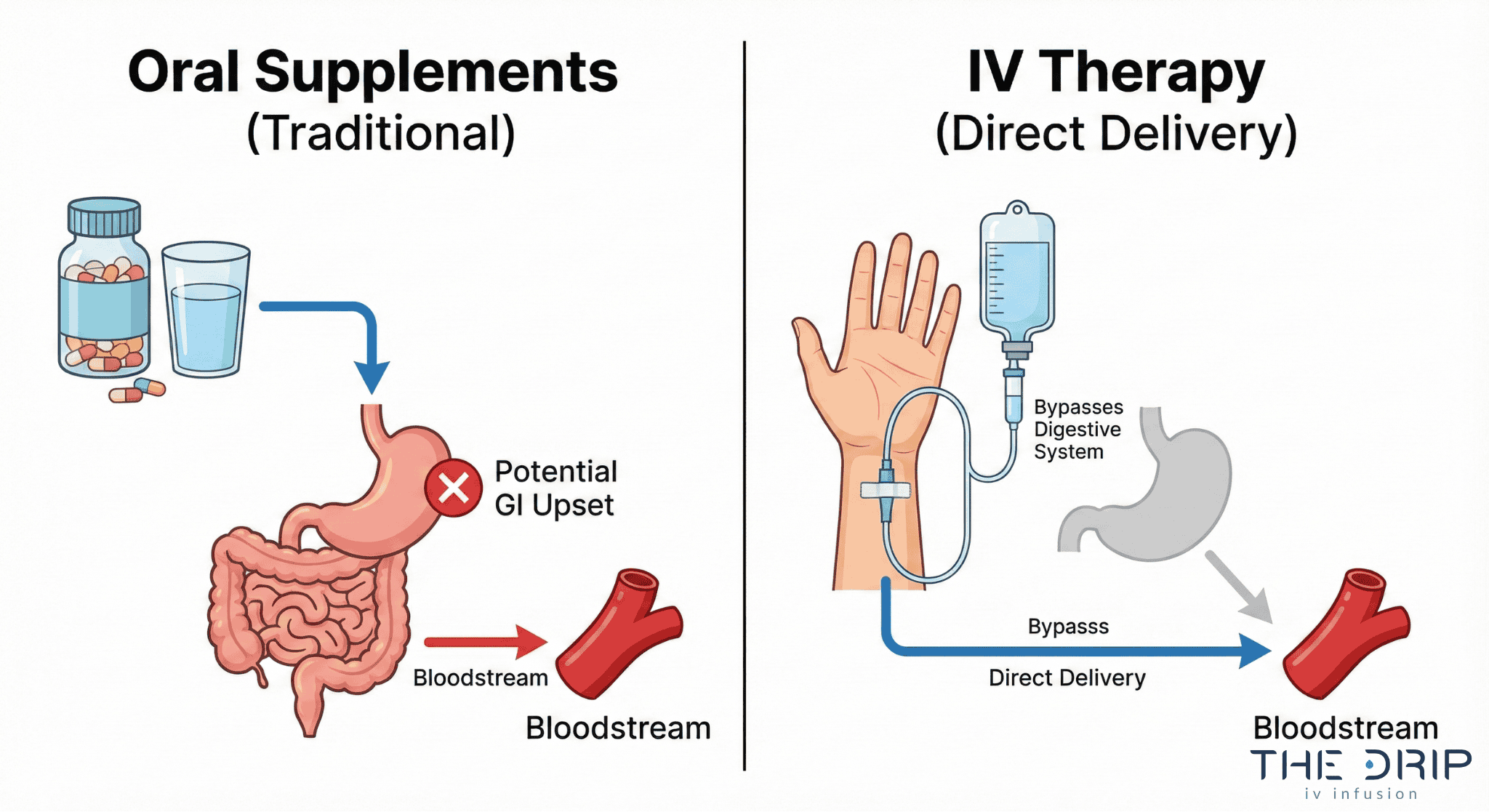Infographic comparing oral supplement digestion route with IV therapy bloodstream delivery.