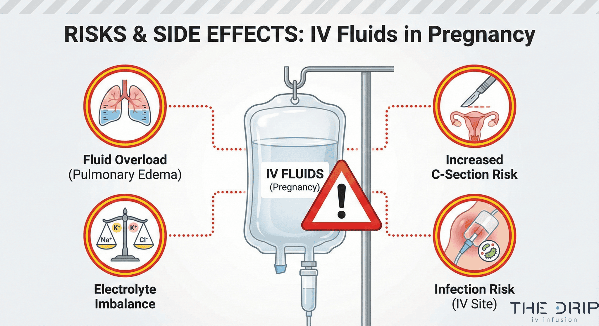 Visual diagram showing risks and side effects of IV fluids during pregnancy.