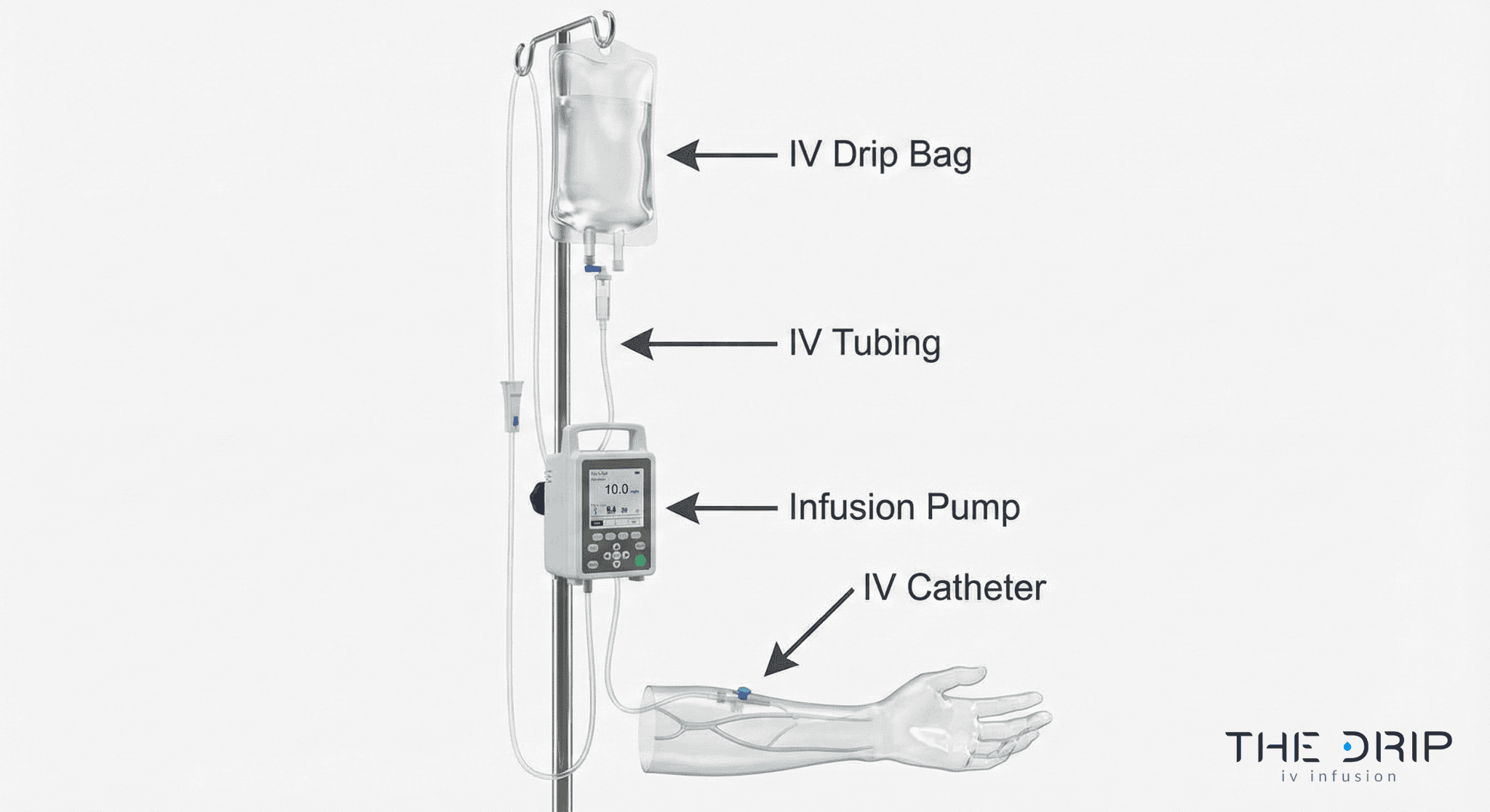 iv-therapy-equipment-setup-diagram Diagram showing labeled IV therapy equipment including catheter, tubing, and pump.